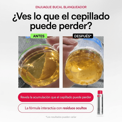 Hismile iD Stain — Enjuague Bucal Revelador - Upper