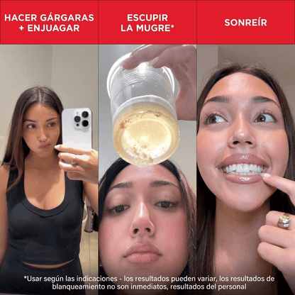 Hismile iD Stain — Enjuague Bucal Revelador - Upper