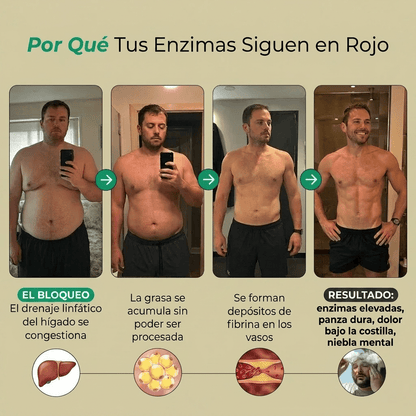 Nueva fórmula de máxima potencia: cápsulas de drenaje hepático de Sculptique™ - Upper