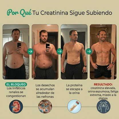 Nueva fórmula de máxima potencia: cápsulas de drenaje linfático de Sculptique™. - Upper
