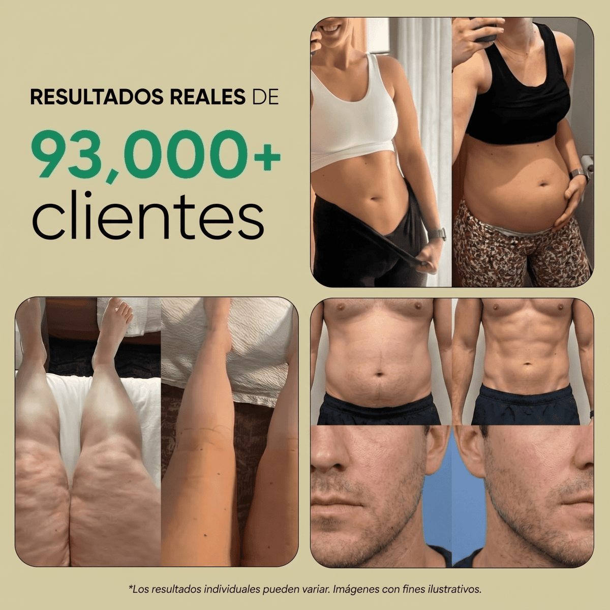 Nueva fórmula de máxima potencia: Cápsulas de drenaje linfático renal de Sculptique™ - Upper